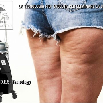 Voglia di tornare in forma eliminando la fastidiosa cellulite e le adiposità cutanee? FISIOSPHERE è la tecnologia più evoluta per risolvere questi inestetismi!